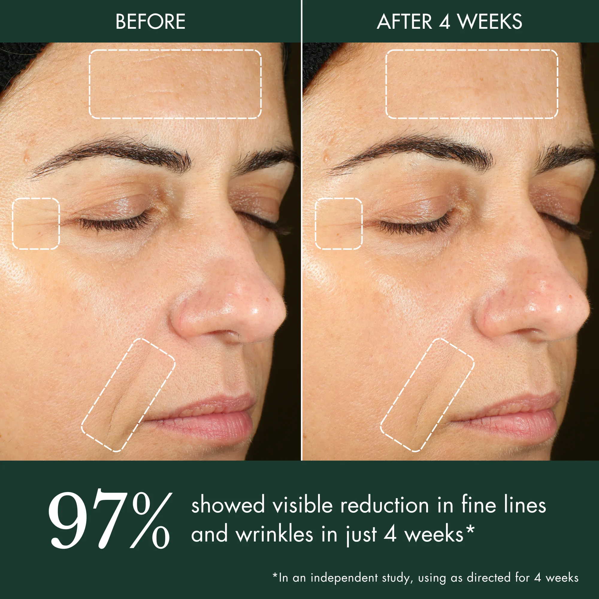 Hydrogel Moisturizer / Hyaluronic Acid Water Cream